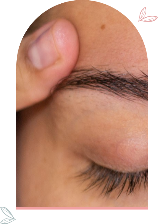 Tratamiento antiojeras