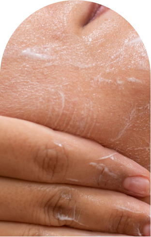 Tratamiento limpieza facial